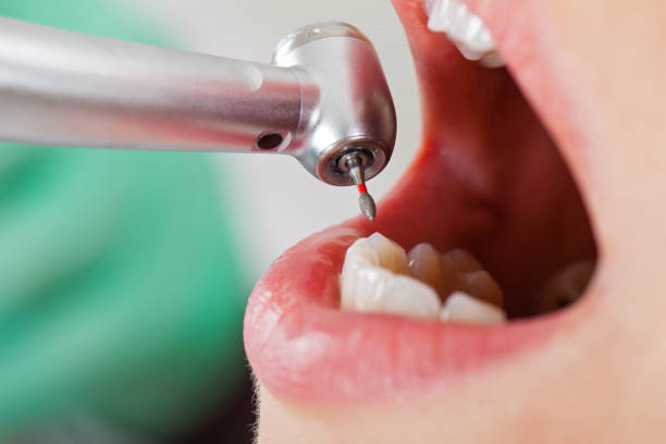 Best Emergency Broken Tooth Repair in Lake Meade, PA